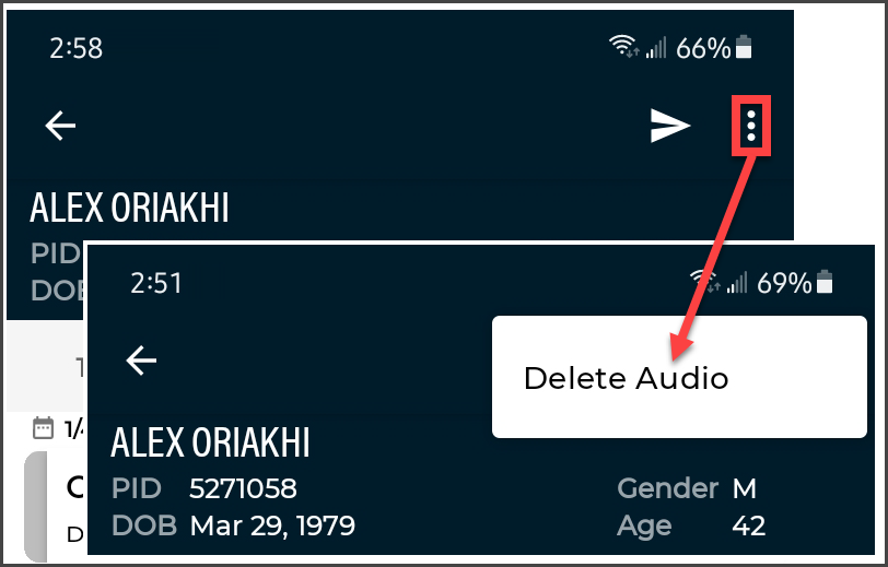 Delete Audio